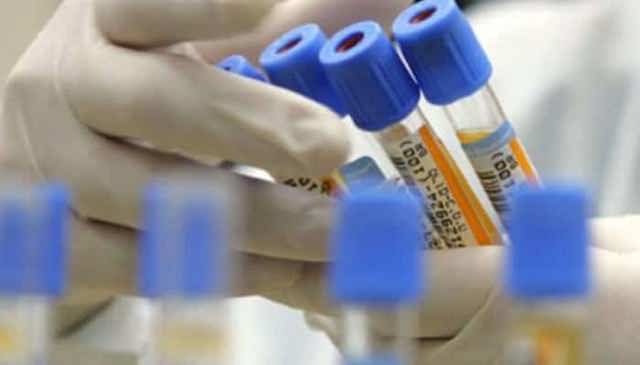 Caz de infecție cu hantavirus confirmat în România. Autoritățile spun că nu are legătură cu focarul de pe nava de croazieră