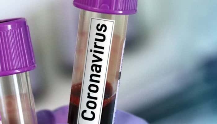 Românii izolați la domiciliu beneficiază de concedii medicale și scutiri. Cum sunt aprovizionați cei care nu au voie să părăsească locuința