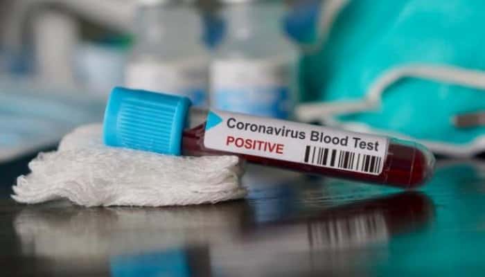 CORONAVIRUS | Încă patru decese anunțate joi seară! Un bărbat din Timiș a murit la 49 de ani după ce a fost trimis de două ori acasă, netestat, diagnosticat cu pneumonie