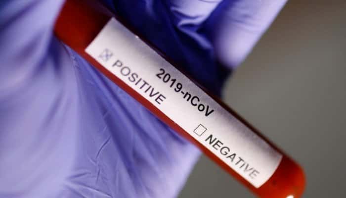 CORONAVIRUS | Trei noi decese la persoane infectate cu Covid-19. Bilanțul a ajuns la 17