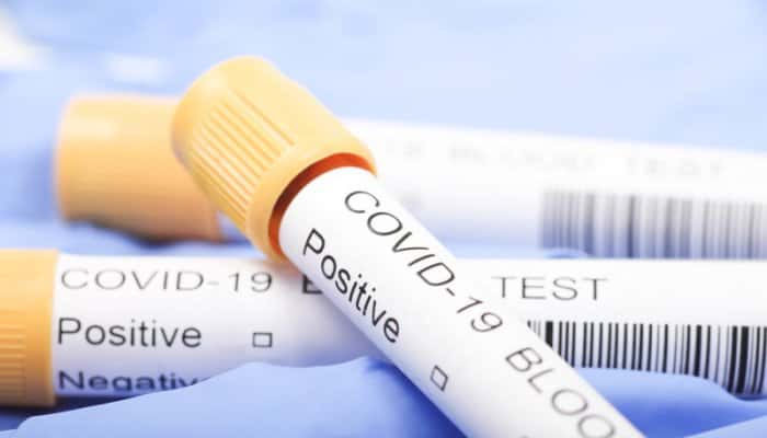 CORONAVIRUS. Încă trei decese adăugate bilanțului din România 