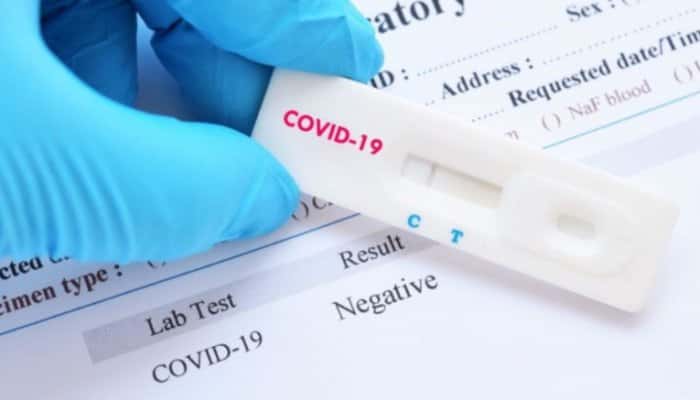 CORONAVIRUS | 325 de infectări noi, 10 decese şi 349 de externări raportate în ultimele 24 de ore