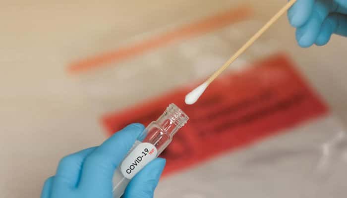 CORONAVIRUS | 160 de decese şi 9685 de infectări confirmate în ultimele 24 de ore în România