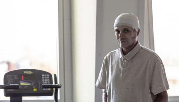 Cătălin Denciu, medicul-erou rănit în incendiul de la Spitalul Piatra Neamţ, externat după aproape jumătate de an