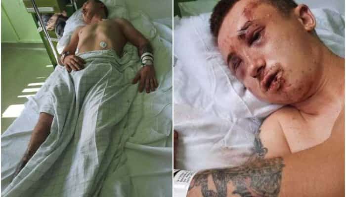Tânăr bătut, dezbrăcat, incendiat și lăsat să moară pe un trotuar, în Arad