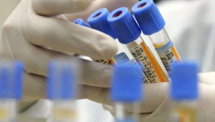 asigurați sănătate servicii gratuite